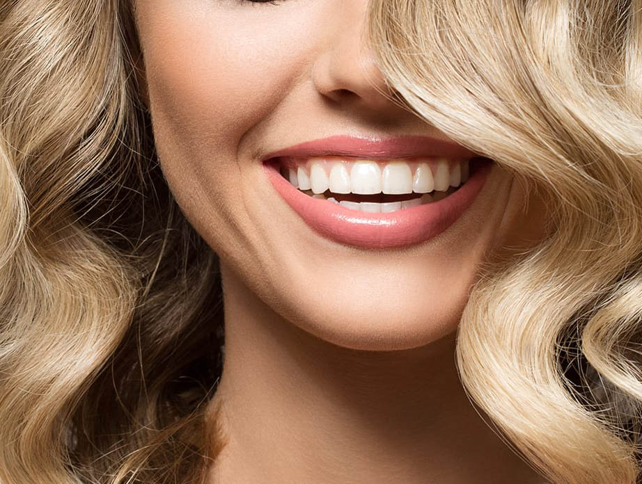 fatete dentare emax
