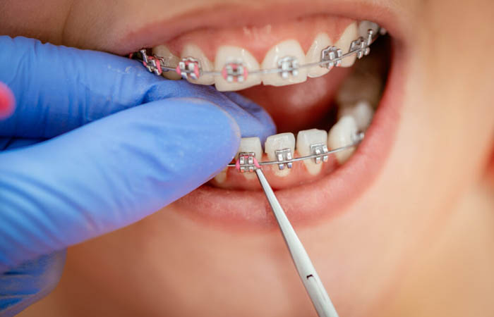 ortodontie